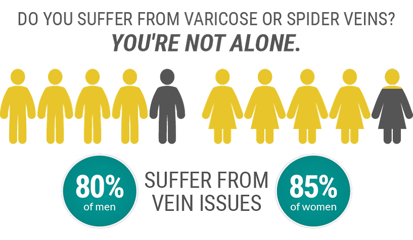 80% of men and 85% of women suffer from some form of spider or varicose veins in their adult life.