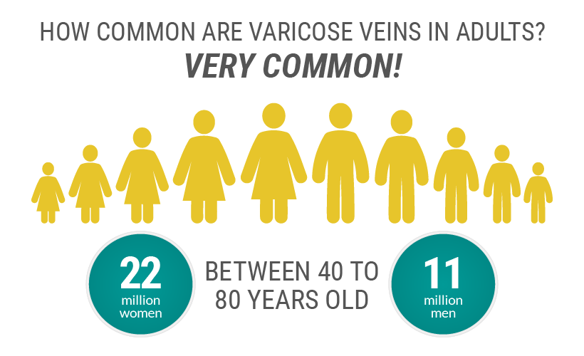 Varicose veins affect 22 million women and 11 million men between the ages of 40 to 80 years.