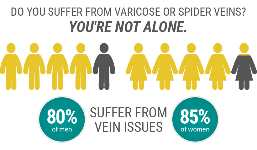 80% of men and 85% of women suffer from some form of spider or varicose veins in their adult life.